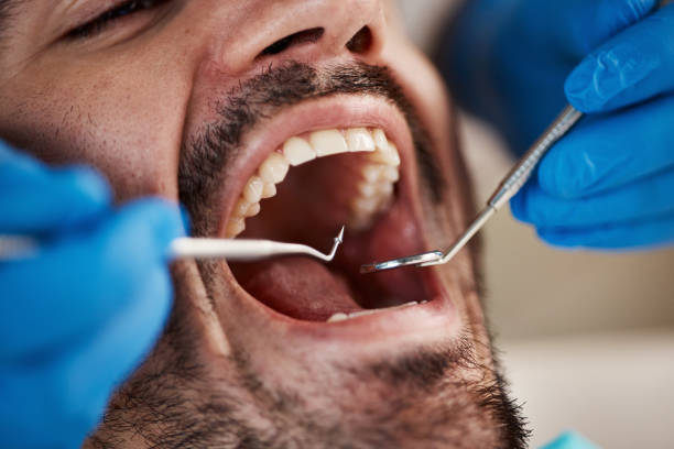 Best Cracked Tooth Emergency Dentist  in Heflin, AL